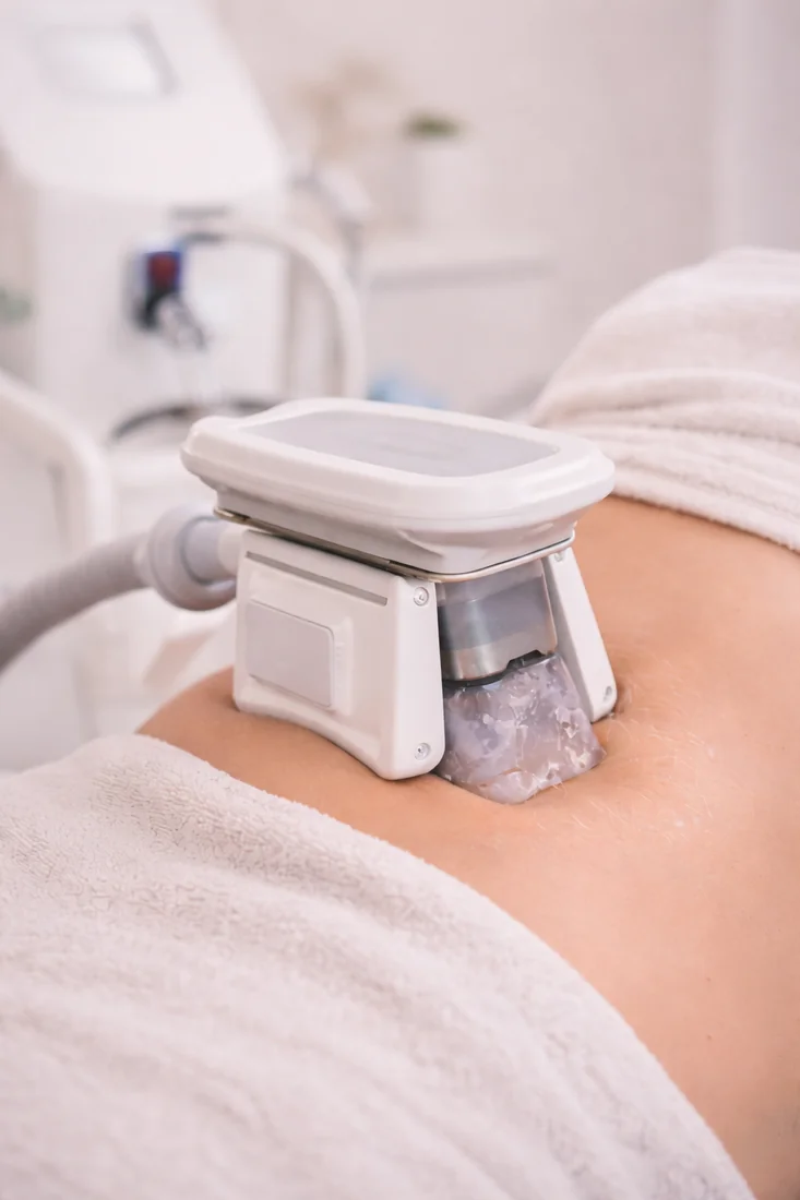 Cryolipolyse 2 zones Bruxelles — Harmony Beauty Clinic