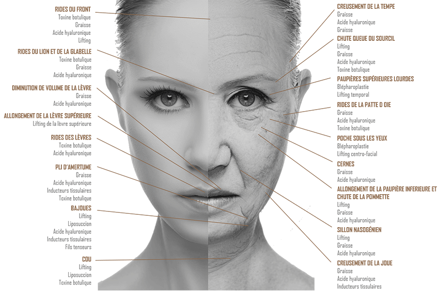 VIEILLISSEMENT-DU-VISAGE